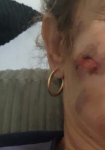 דנה רביבו קוסמטיקאית חבלות בפרצוף אחרי טיפול